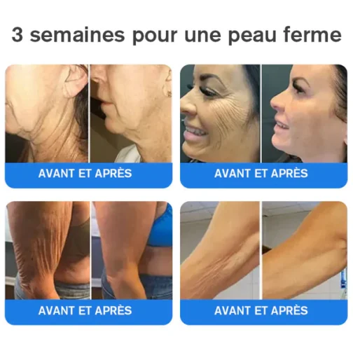 Firming and Anti-Wrinkle with Emu Oil - Image 3